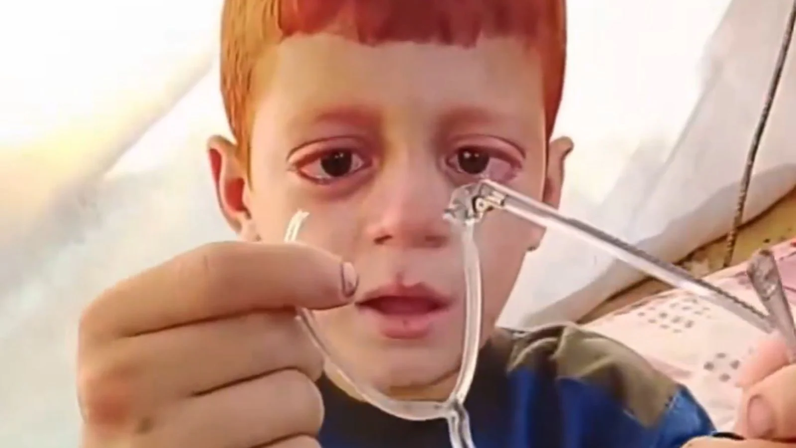 ‘Why can’t I be like different kids’: Gaza boy cries over damaged spectacles | Video | World Information